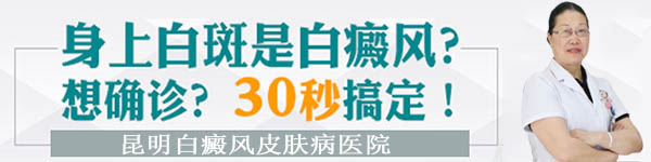 在线咨询